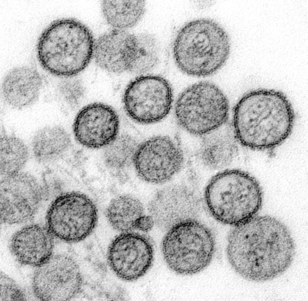 Některé formy hantavirů jsou nebezpečnější než jiné Kam se hrabe koronavirus: 5 nejnebezpečnějších virů planety