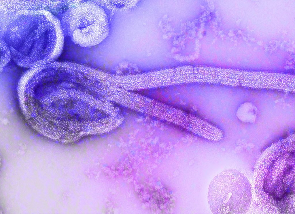 Lék na Ebolu stále čeká na svého objevitele Kam se hrabe koronavirus: 5 nejnebezpečnějších virů planety